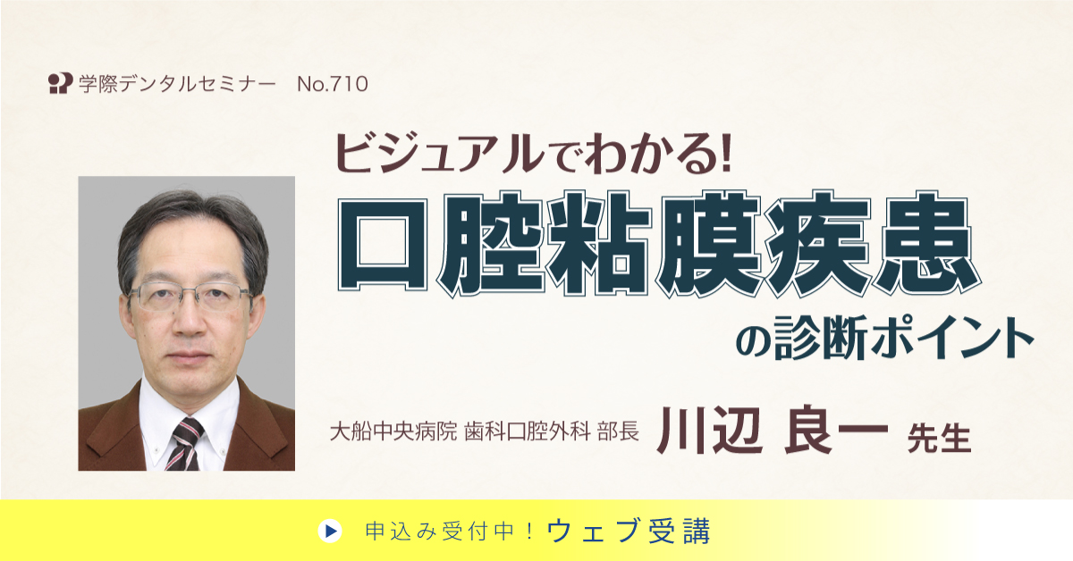 No.710　ビジュアルでわかる！口腔粘膜疾患の診断ポイント